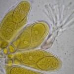 Phyllactinia guttata asci