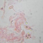 Stypella dubia basidiospore