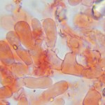 Brevicellicium olivascens subhym