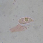 Hyphoderma tibia spore