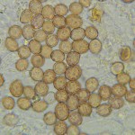Chromocyphella muscicola spores2