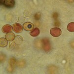 Chromocyphella muscicola dextrinoid spores