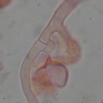 Saccoblastia farinacea clamp