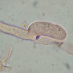 Saccoblastia farinacea probasidia