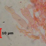 Cerocorticium sulfureoisabellinum cystidia