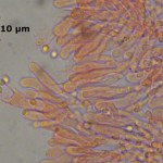 Ceraceomyces microsporus hymenium