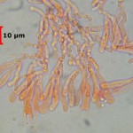 Ceraceomyces microsporus hymenium 2