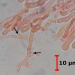 Ceraceomyces microsporus clamps