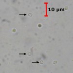 Ceraceomyces microsporus spores2