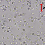 Ceraceomyces microsporus spores