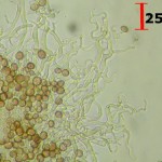 Phleogena faginea hyphae