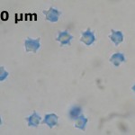 asterostroma medium spores cb