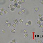 asterostroma medium spores in water