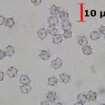 asterostroma medium spores melzer