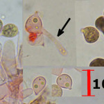Scotomyces subviolaceus spores