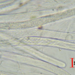 Acanthophiobolus helicosporus asci