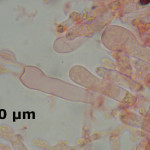 Merulicium fusisporum basidia