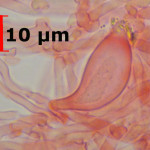 Auriporia aurulenta lamprocystidia