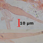 Conohypha terricola cystidia