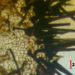 Acanthophiobolus helicosporus setae