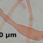 Auriporia aurulenta leptocystidia