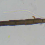Acanthophiobolus helicosporus sete