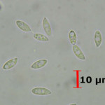 Merulicium fusisporum spores
