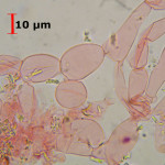 Conohypha terricola subhymenium