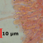 Merulicium fusisporum cystidia