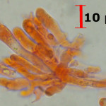 Xylodon asperus Basidia