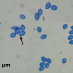 Lindtneria panphyliensis spores
