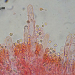 Stypella vermiformis hymenium
