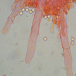 Stypella vermiformis cystidia
