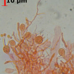 Stypella vermiformis hymenium hyphidia